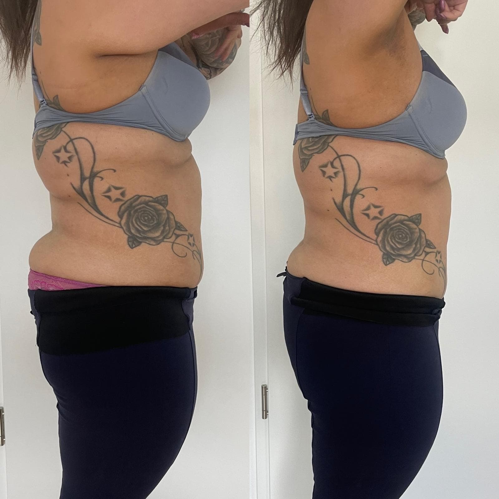 EMS Sculpter NEO Behandlung bei Nue Beauty