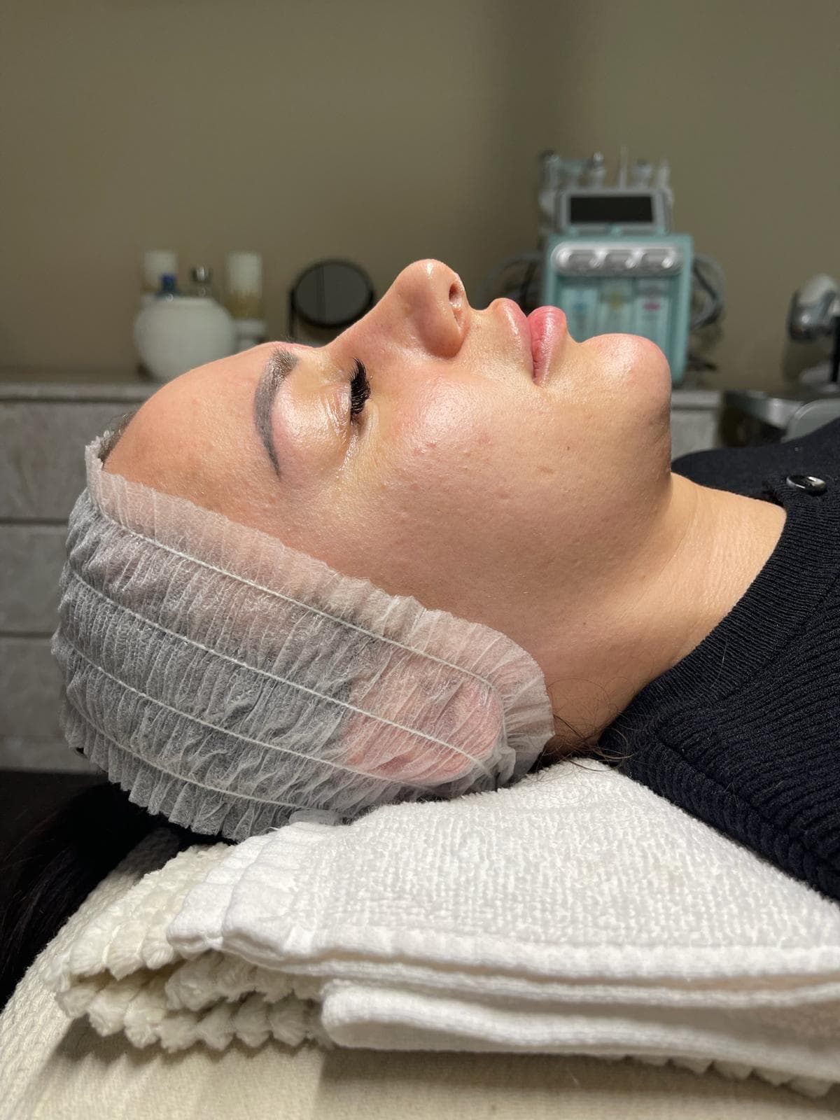 RF Crystal Microneedling 8