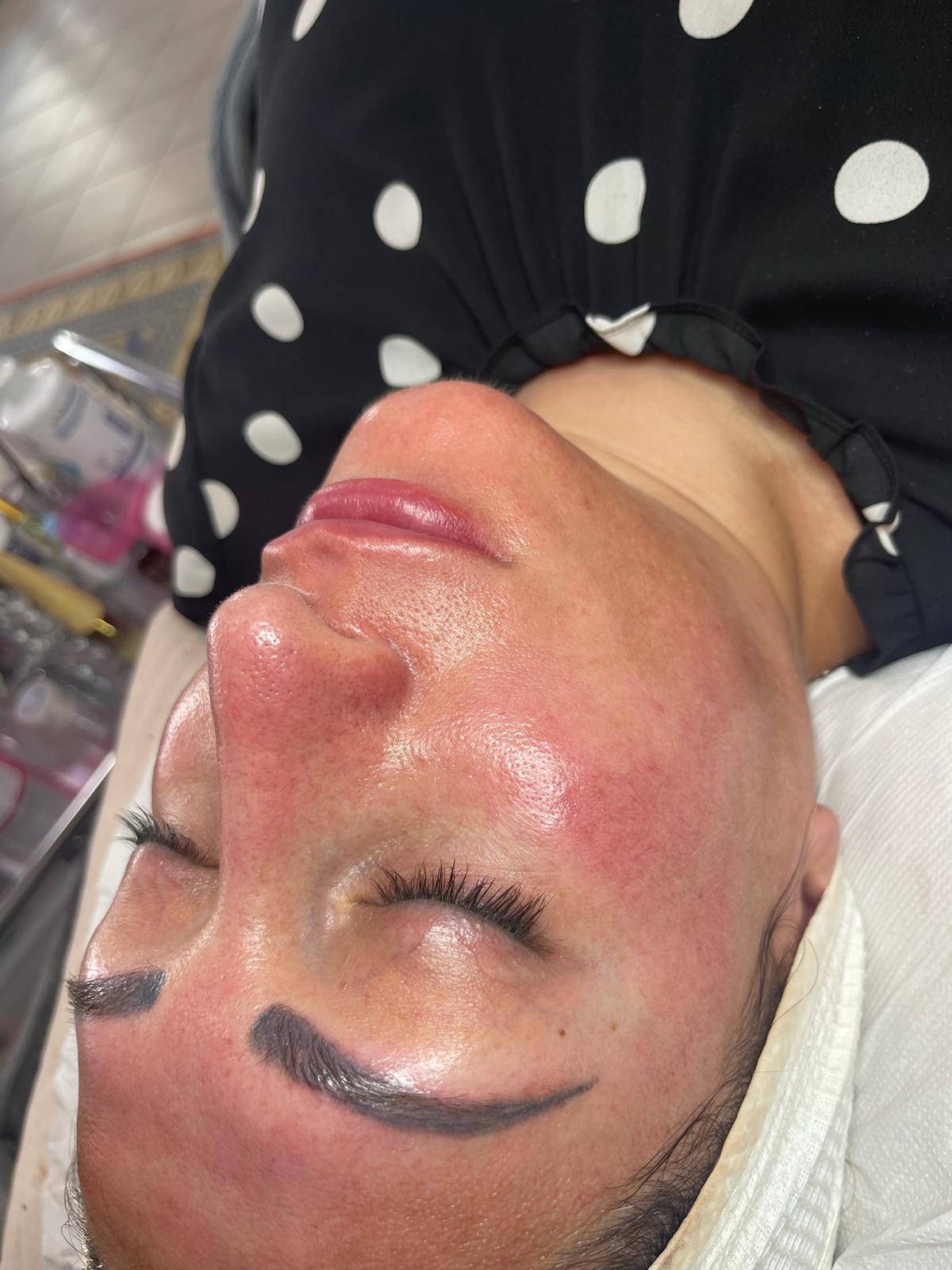 AquaFacial Gesichtsbehandlung bei Nue Beauty